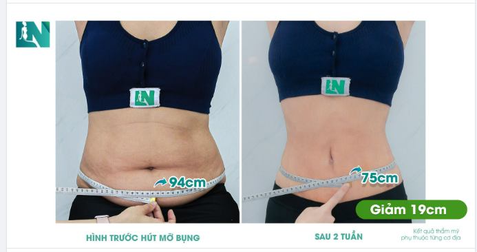 BÍ QUYẾT LẤY LẠI DÁNG VÓC SAU SINH SAU 2 GIỜ