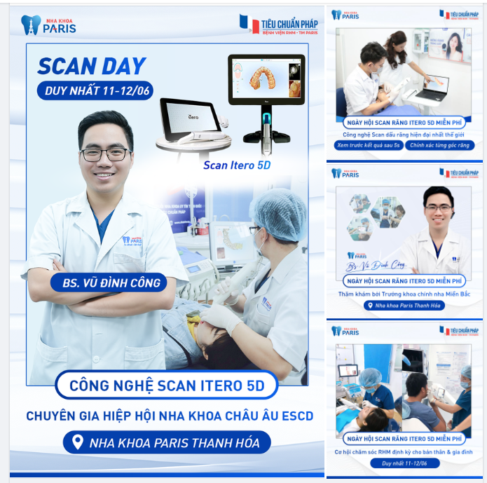 NGÀY HỘI SCAN RĂNG ITERO 5D MIỄN PHÍ