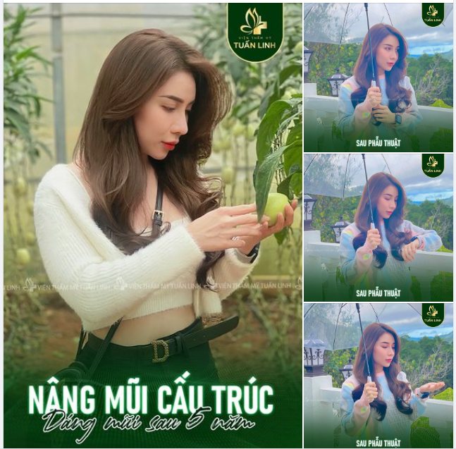 MUỐN NÂNG MŨI BỀN ĐẸP KHÔNG KHÓ