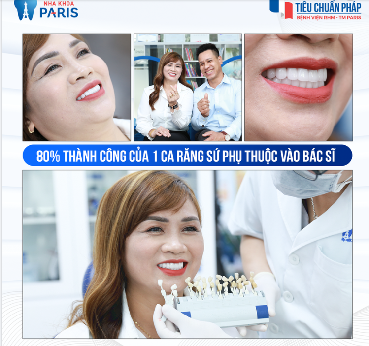 80% THÀNH CÔNG CỦA MỘT CASE RĂNG SỨ PHỤ THUỘC VÀO TAY NGHỀ CỦA BÁC SĨ!