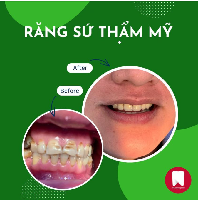 THÊM 1 NỤ CƯỜI - THÊM NHIỀU NIỀM VUI