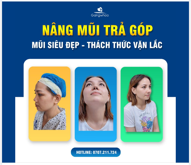 NÂNG MŨI TẠI NHÀ BÁC SĨ PARK CÓ GÌ MỚI?