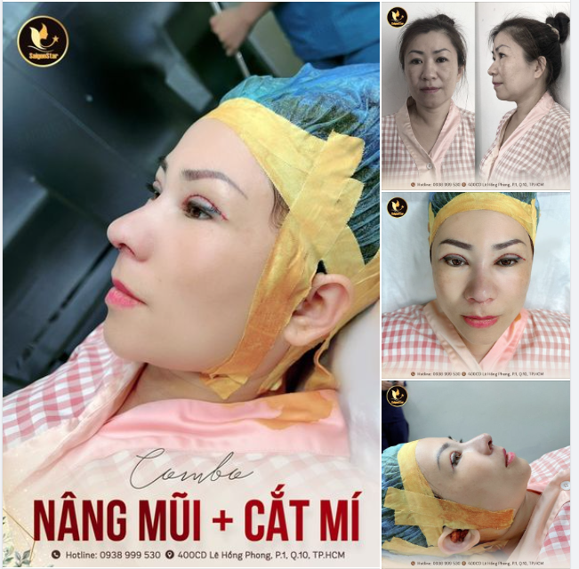 DÁNG MŨI SIÊU ĐỈNH – NẾP MÍ HOÀN CHỈNH CHO CHỊ XUÂN ĐÀO (AN GIANG)