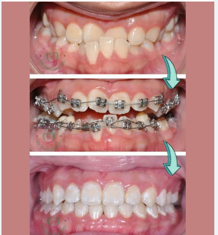 Hè đến rồi thì các bạn Nhỏ làm gì nè?