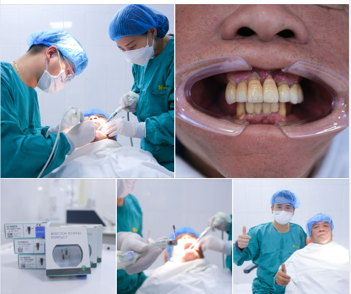 CẢI THIỆN SỨC KHỎE, TUỔI GIÀ TRỌN VẸN NHỜ TRỒNG RĂNG IMPLANT