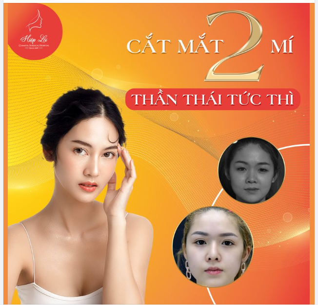 CẮT MẮT 2 MÍ, THẦN THÁI TỨC THÌ