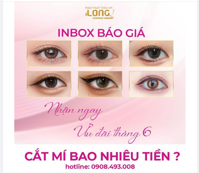 CẮT MÍ GIÁ BAO NHIÊU, KHÔNG CÓ NHIỀU CHI PHÍ CÓ THỂ CẮT MÍ KHÔNG???