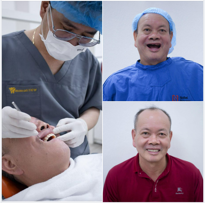 LẤY LẠI HÀM RĂNG KHỎE ĐẸP NHỜ TRỒNG RĂNG IMPLANT CÔNG NGHỆ XÂM LẤN TỐI THIỂU