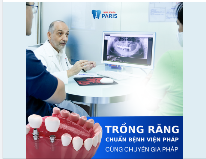 TRỒNG RĂNG IMPLANT CHUẨN BỆNH VIỆN PHÁP