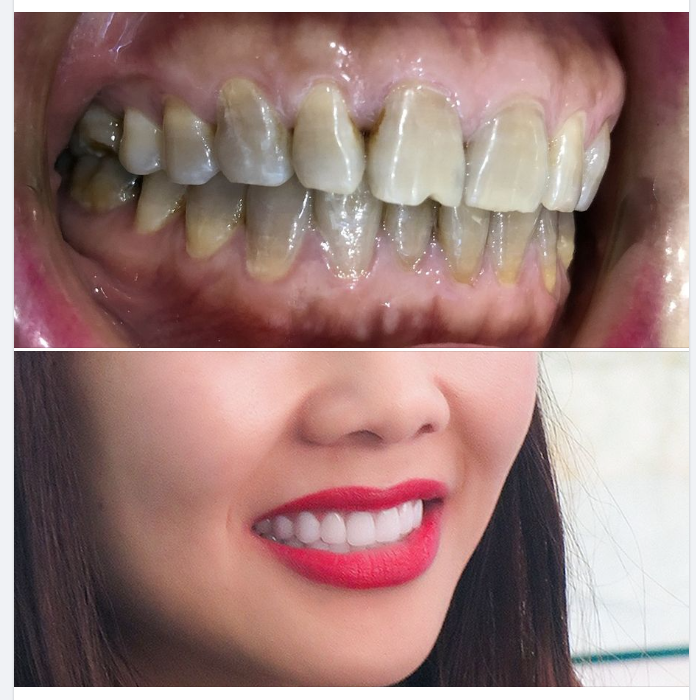 Rất đáng để làm