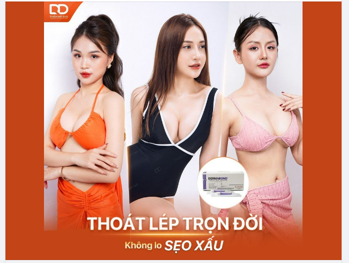 THOÁT LÉP TRỌN ĐỜI - KHÔNG LO SẸO XẤU