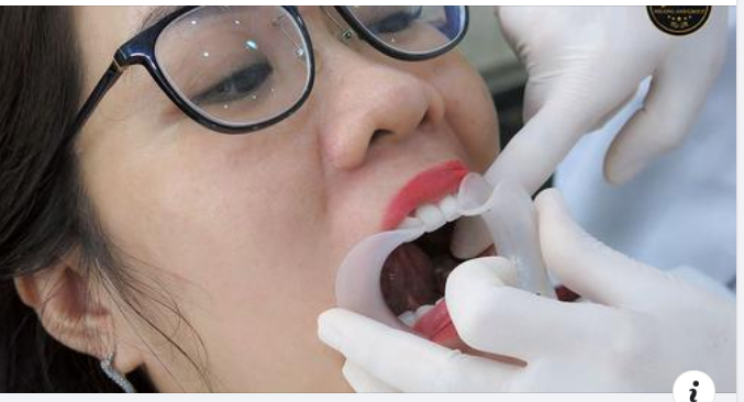 Bọc răng sứ thẩm mỹ là gì? có tốt không? có đau không?