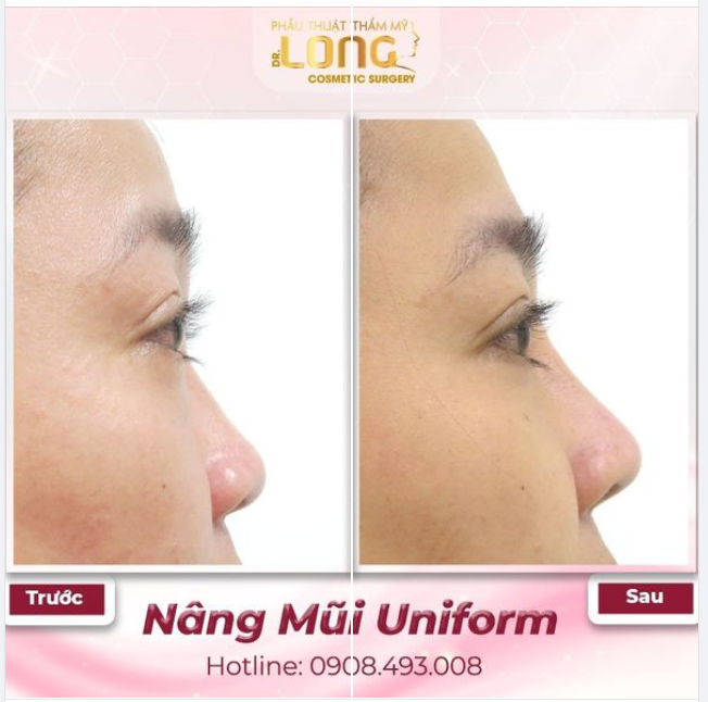 ĐÓN HÈ SANG CÙNG DÁNG MŨI MỚI GIÚP BẠN THAY ĐỔI 80% NHAN SẮC
