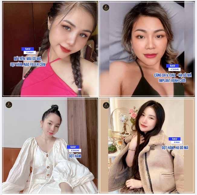 THAY ĐỔI ĐỂ ĐẸP HƠN MỖI NGÀY!