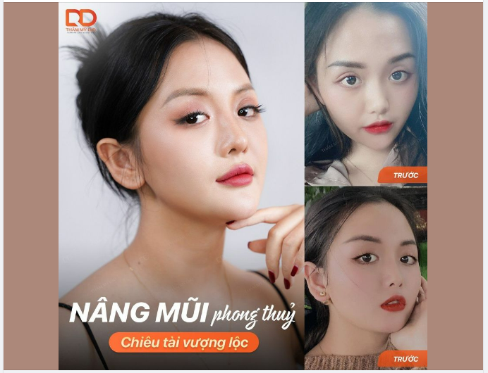 THAY ĐỔI VẬN MỆNH SAU NÂNG MŨI. TẠI SAO KHÔNG?
