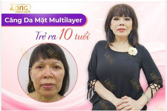 DÙ LÀ NGÀY NẮNG HAY MƯA, KHÁCH HÀNG VẪN GHÉ ĐẾN BSLONG LÀM ĐẸP