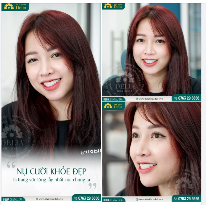 Nụ cười khỏe đẹp chính là trang sức lộng lẫy nhất của chúng ta