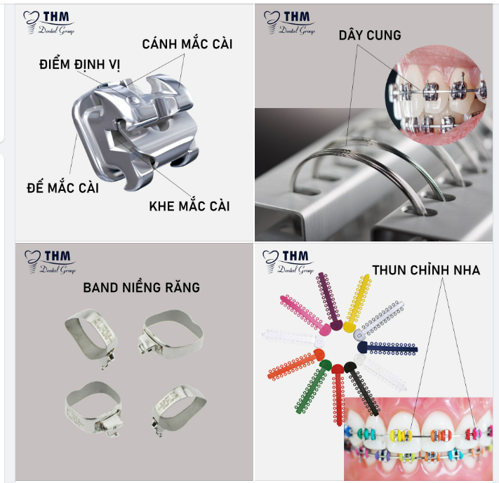 CÁC LOẠI KHÍ CỤ CHỈNH NHA CƠ BẢN: