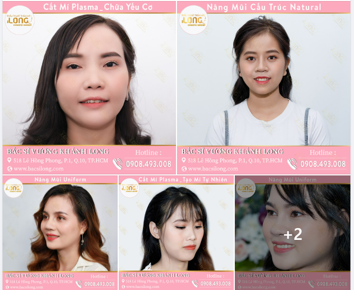 ĐẰNG SAU VẺ ĐẸP RẠNG NGỜI LÀ GÌ ?