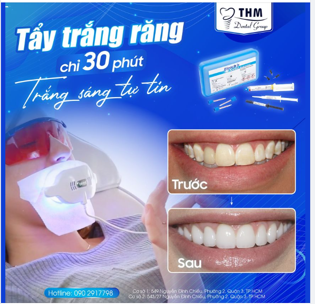 TẨY TRẮNG RĂNG BEYOND 30P CHO RĂNG TRẮNG SÁNG TỰ TIN