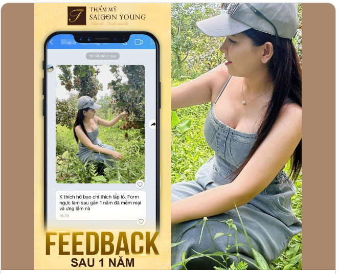 Khách hàng chia sẻ: " Không thích hở bạo chỉ thích lấp ló, from ngực làm sau gần 1 năm đã mềm mại và ưng lắm nà "