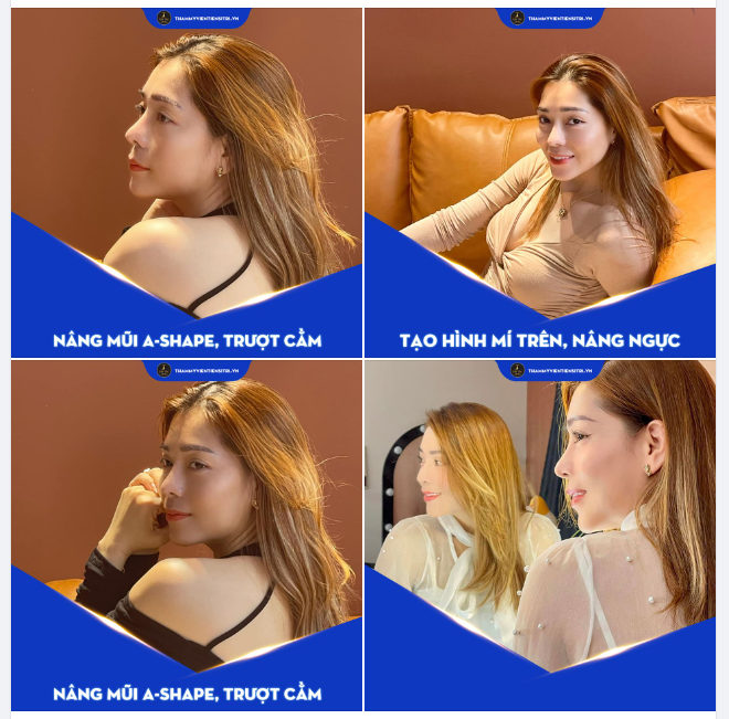 TỎA SÁNG TỪNG GIÂY VỚI NHAN SẮC RẠNG RỠ