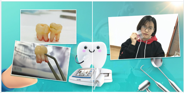 GÓC FEEDBACK BUÔNG BỎ 2 CHIẾC RĂNG KHÔN CÒN NHANH HƠN NGƯỜI YÊU CŨ