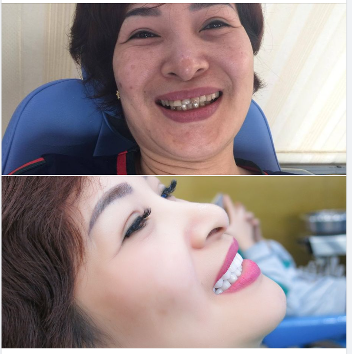 Nói thật mà họ tưởng giả vờ