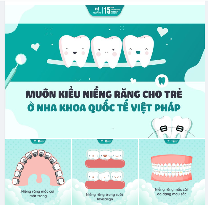 MUÔN KIỂU NIỀNG RĂNG CHO TRẺ Ở VIỆT PHÁP