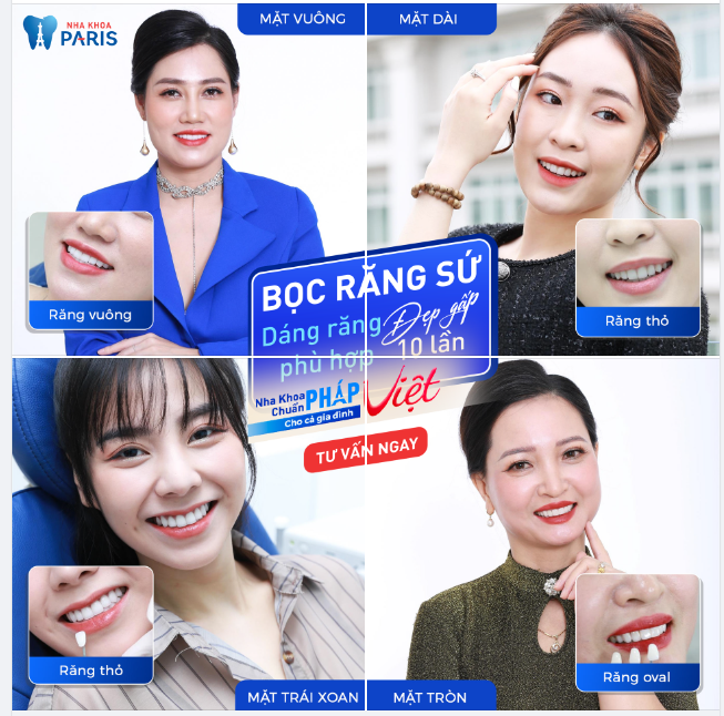 Răng Sứ - Tinh Hoa Nghệ Thuật Gương Mặt