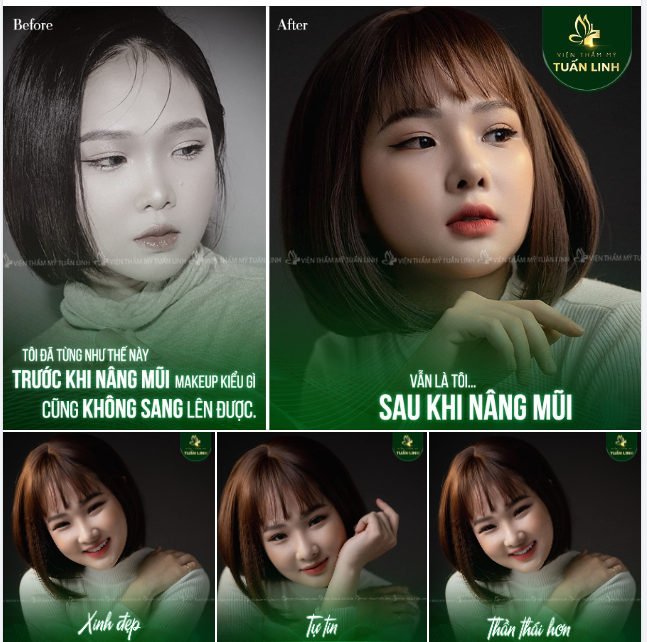 Chỉ cần sống mũi cao thêm một chút, gương mặt bạn sẽ thay đổi hoàn toàn!!