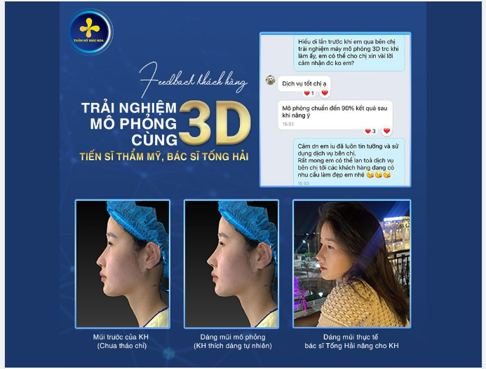 FEEDBACK CỦA KHÁCH HÀNG HIẾU PHẠM – TRẢI NGHIỆM CÔNG NGHỆ MÔ PHỎNG 3D  NÂNG MŨI SỤN HÀN BỌC SỤN TAI BỞI TIẾN SĨ THẨM MỸ, BÁC SĨ TỐNG HẢI.