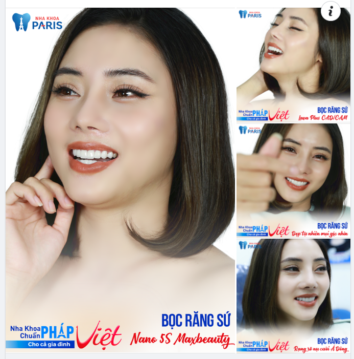 Vốn đã có một gương mặt bầu bĩnh, xinh xắn đúng chuẩn phụ nữ Á Đông, bọc bộ 18 răng sứ Lava Plus kết hợp công nghệ AI thiết kế dáng răng càng tôn thêm nét rạng rỡ của cô nàng Trang Bùi.