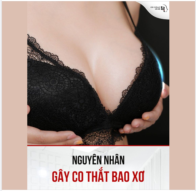 BAO XƠ LÀ GÌ, NGUYÊN NHÂN GÂY CO THẮT BAO XƠ