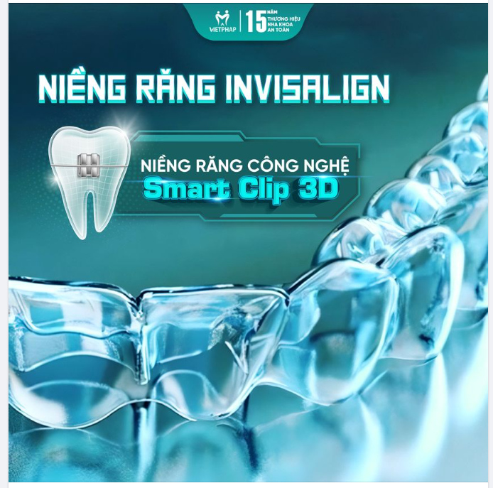 Niềng răng Invisalign công nghệ Smart Clip 3D