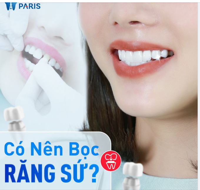 CÓ NÊN BỌC RĂNG SỨ KHÔNG?