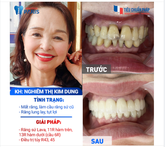 "Làm xong, cô ăn một bát bún chả ngon lành luôn!"