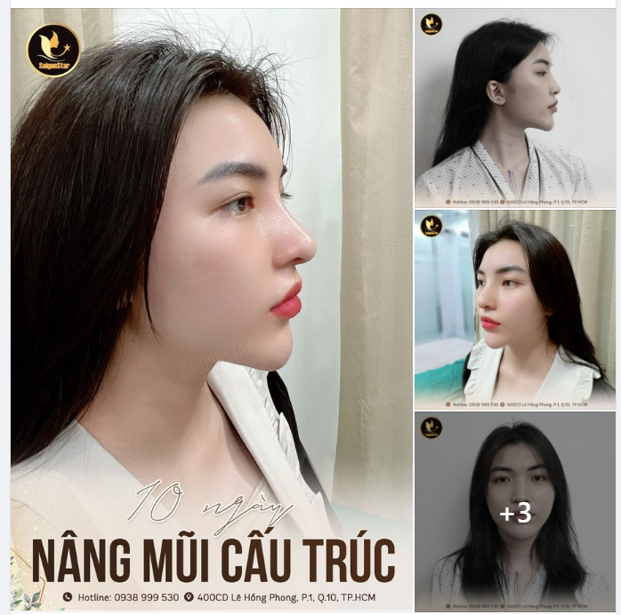 PHÁI NỮ XINH ĐẸP LÀ MỘT LỢI THẾ