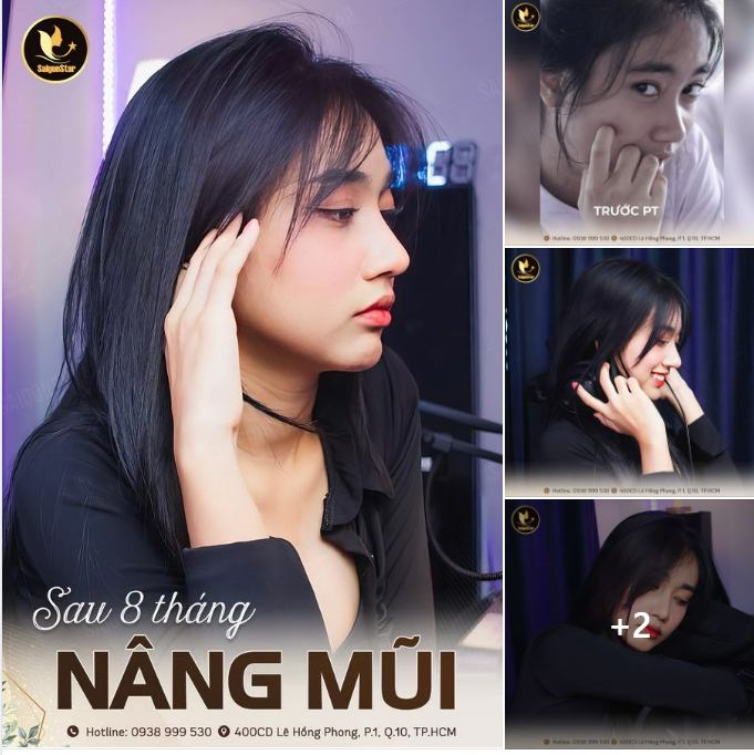 “Xấu quen rồi, từ lúc được Bác sĩ Hoạt nâng mũi đẹp quá lại không quen”