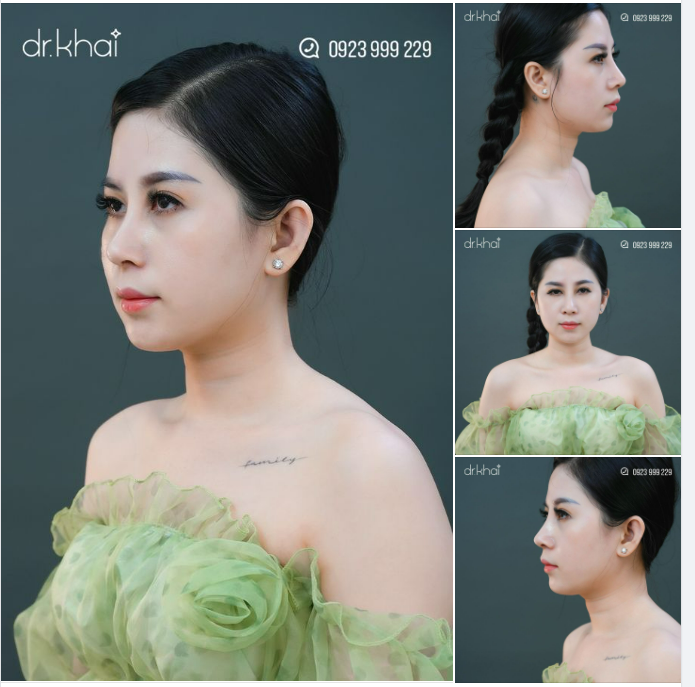 DÁNG MŨI SANG - MẶT CHUẨN TỶ LỆ VÀNG