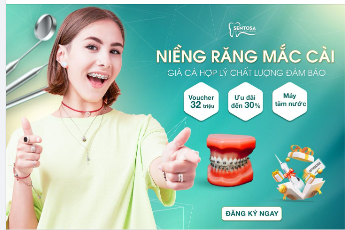 NIỀNG RĂNG MẮC CÀI GIÁ CẢ HỢP LÝ, CHẤT LƯỢNG ĐẢM BẢO