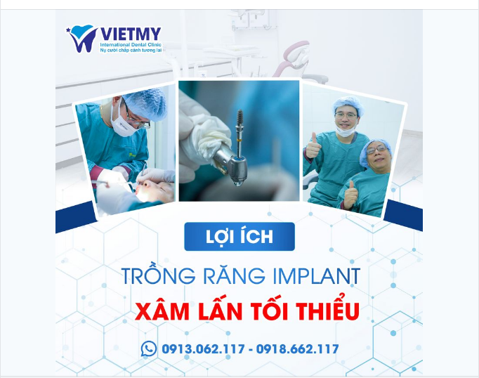 Một bước tiến đột phá trong công nghệ cấy ghép implant Chính là TRỒNG RĂNG XÂM LẤN TỐI THIỂU đã được ứng dụng rộng rãi ở nhiều quốc gia thế giới. Mang đến cho hàng triệu người những chiếc răng giả hoàn hảo nhất.