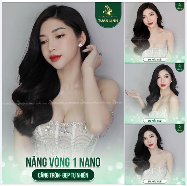 Feedback khách hàng Nâng V1 Nano
