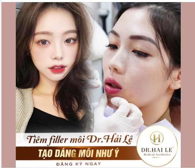 Theo nhân tướng học, người sở hữu dáng môi trái tim thường gặp may mắn trong cuộc sống, thuận lợi trong công việc, chuyện tình duyên như ý.