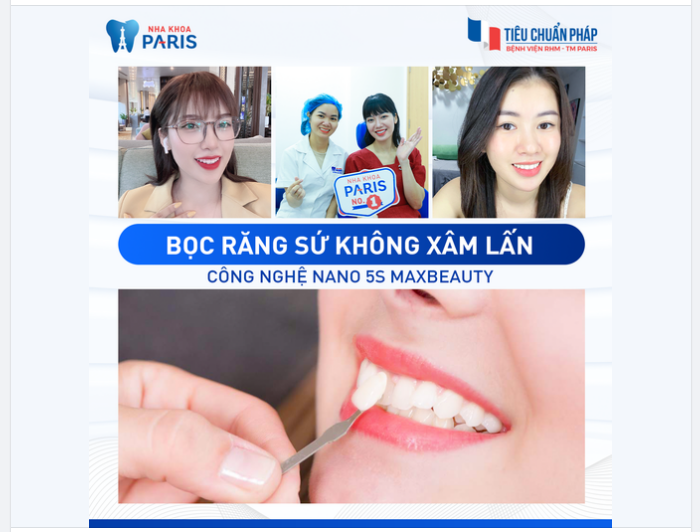 MUỐN BỌC RĂNG SỨ HẠN CHẾ XÂM LẤN Dán sứ Veneer + công nghệ NANO 5S MAX BEAUTY