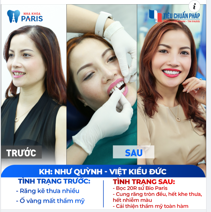 Hành trình Kiến tạo 5000 Nụ cười Xuyên Quốc Gia cùng Hệ thống Nha khoa Paris