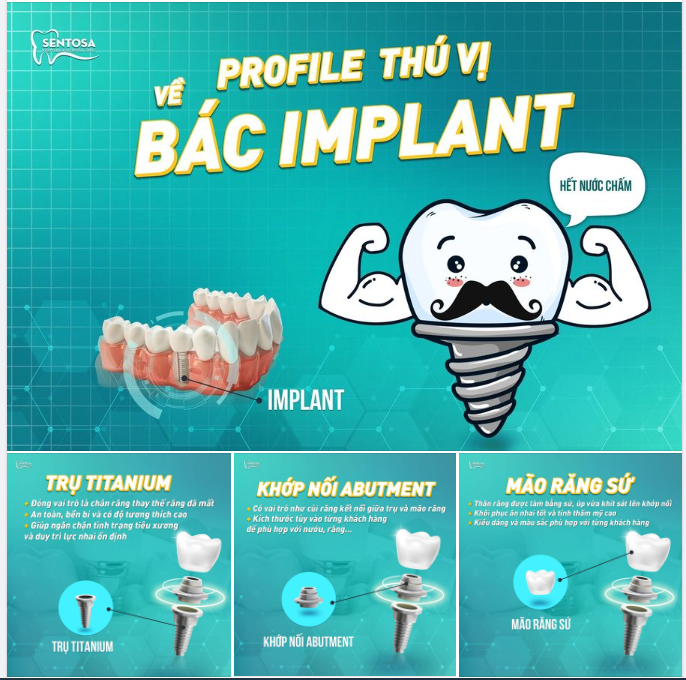 PROFILE THÚ VỊ VỀ BÁC IMPLANT CÓ GÌ NÀO?!!!
