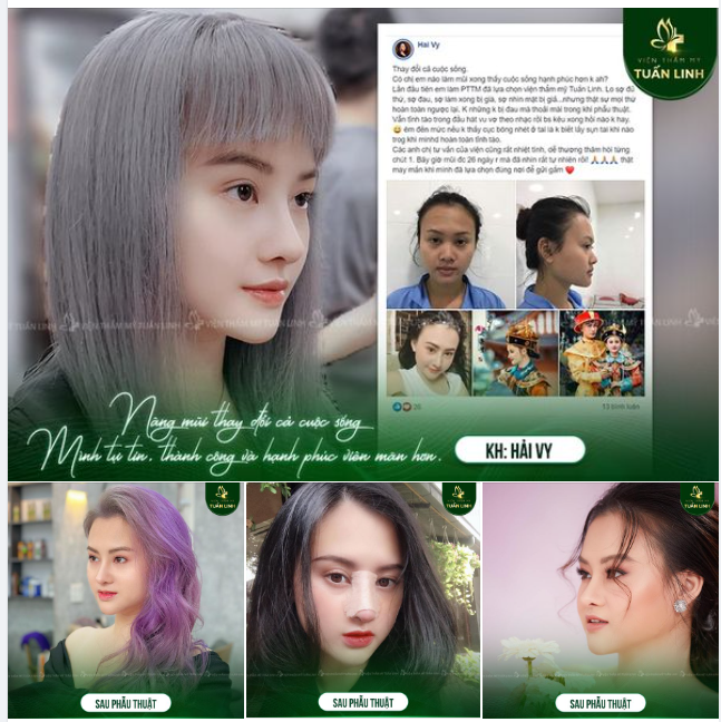 Gửi một chiếc feedback mũi cao bay hợp phong thuỷ để các nàng có thêm động lực làm đẹp. Đến với Tuấn Linh để trở thành phiên bản đẹp nhất của chính mình nha.
