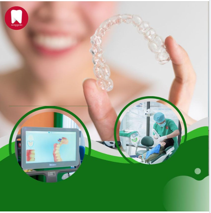 TẠI SAO PHẢI ĐEO KHAY NIỀNG INVISALIGN 20-22H/ NGÀY?