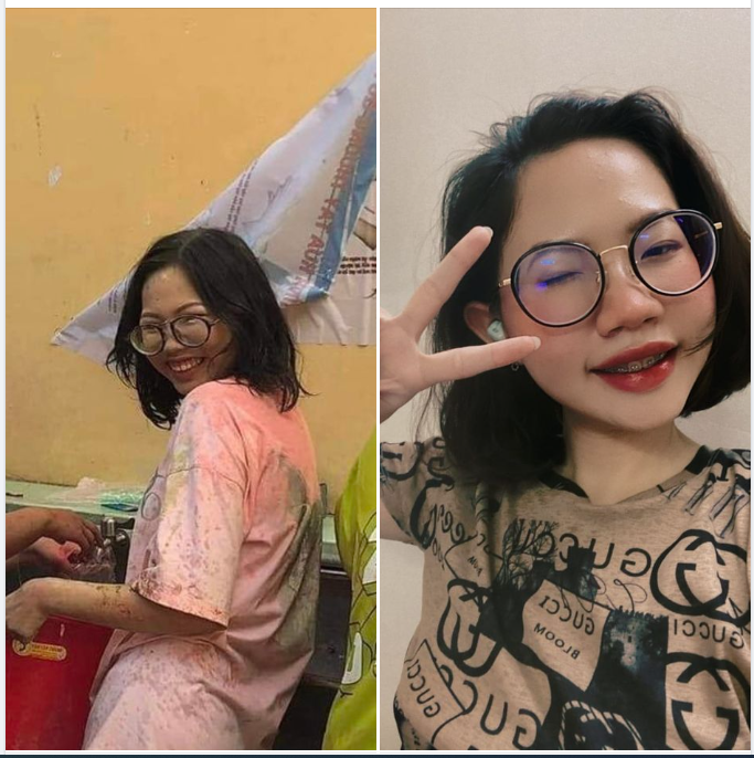 NIỀNG RĂNG CHỈNH NHA - LẤY LẠI TỰ TIN